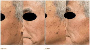Skin-Prestige Cosmetic Dermatology