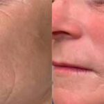 The Secret to Looking Younger Isn’t Changing Your Face—It’s Restoring What Time Has Taken Away