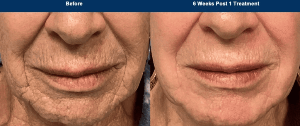 Why There Is No One-Size-Fits-All Cosmetic Treatment: A Personalized Approach to Aging Well