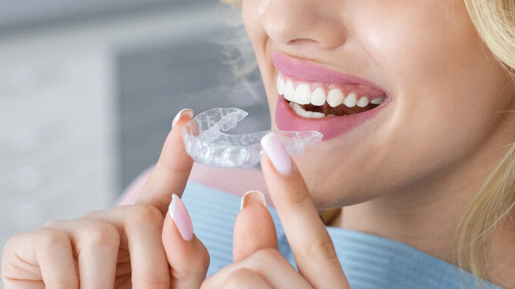 The Importance of Invisalign: More Than Just a Straighter Smile
