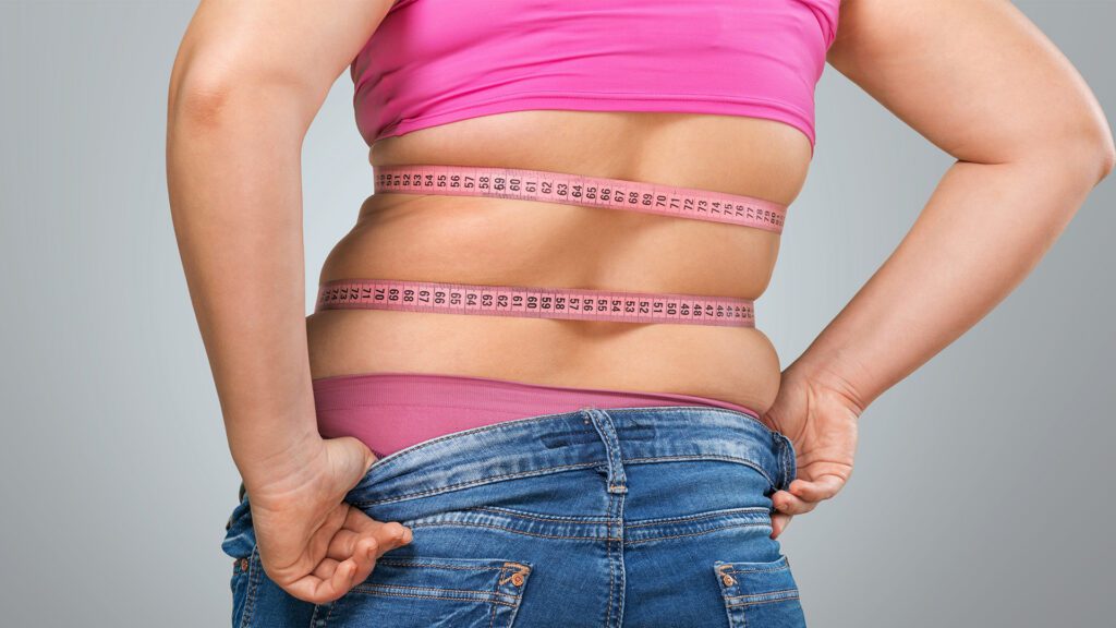 A Medicare Option for Weight Loss