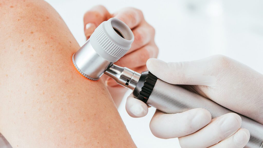 Cyst or Lipoma? Here’s How to Tell the Difference