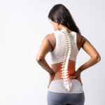 Scoliosis Care in Caledonia: A Non-Surgical Path to Better Posture, Function, and Confidence
