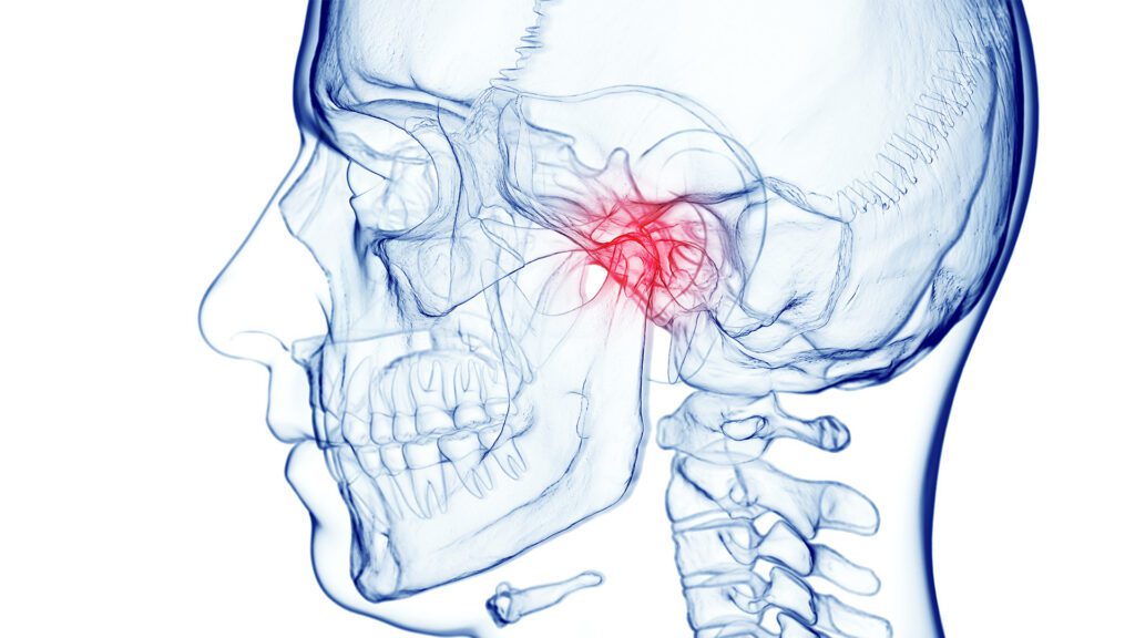 When Jaw Pain isn’t just Jaw Pain