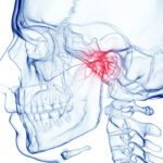 When Jaw Pain isn’t just Jaw Pain