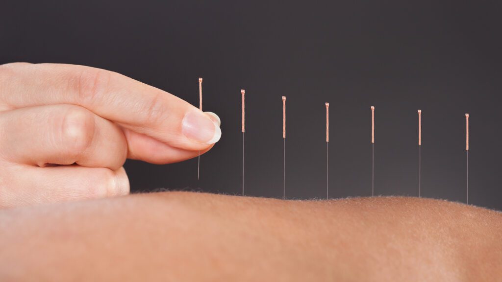 You’re Not Afraid of a Little Needle…Are You?