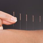 You’re Not Afraid of a Little Needle…Are You?