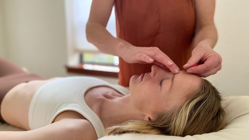 It’s Not “All in Your Head” The Science Behind Why Acupuncture Supports Mental Health