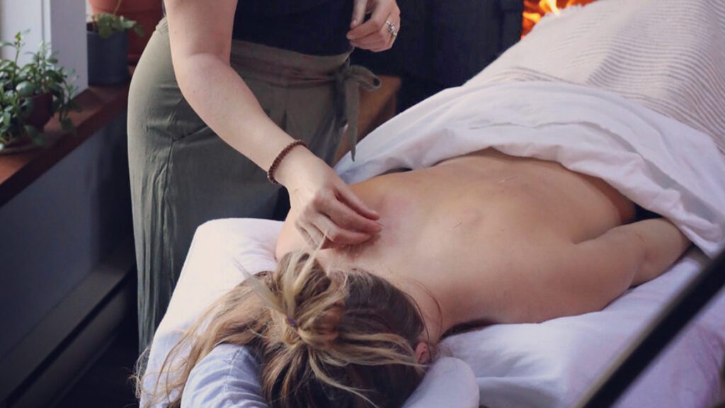 Supporting Pelvic Health with Acupuncture