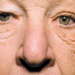 Don’t Underestimate the Sun: Why Protection Matters for Your Health, Your Home, and Your Investments