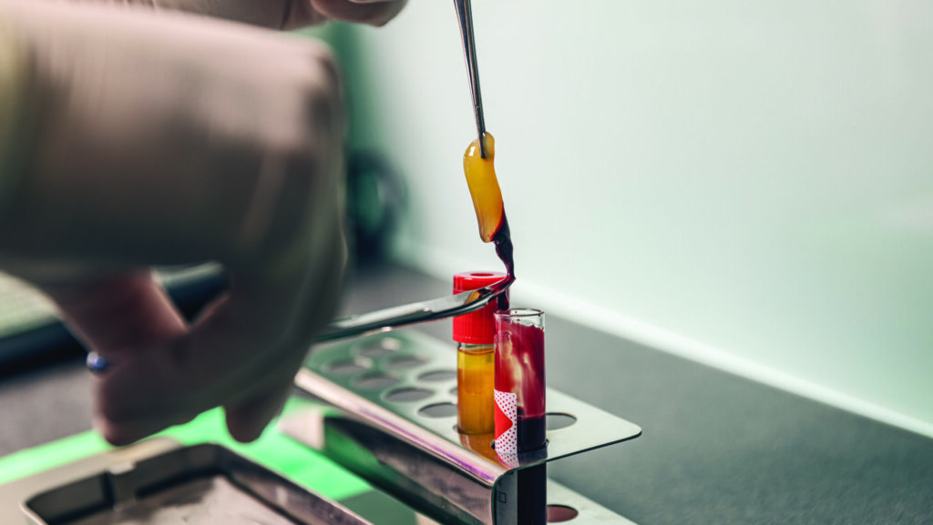 Plasma Rich Fibrin (PRF): Your Body’s Own Healing Power Concentrated