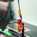 Plasma Rich Fibrin (PRF): Your Body’s Own Healing Power Concentrated