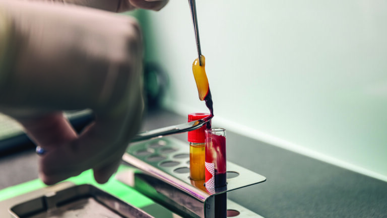 Plasma Rich Fibrin (PRF): Your Body’s Own Healing Power Concentrated