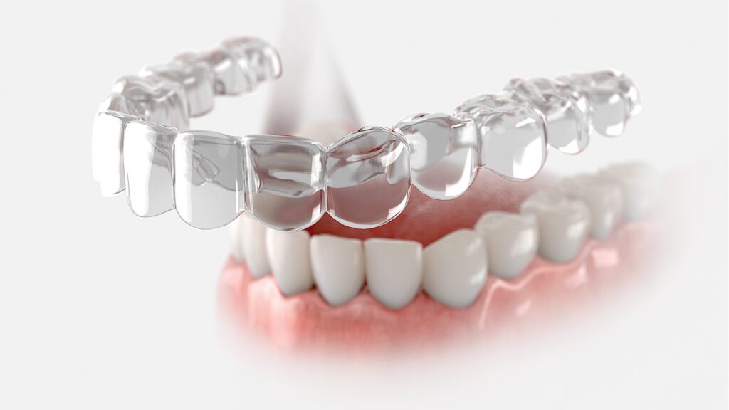 Clear Aligners Have Changed. So Has What’s Possible.
