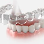 Clear Aligners Have Changed. So Has What’s Possible.