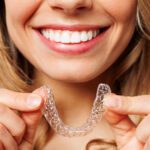 Are Clear Aligners Right for You? Exploring Alternatives to Traditional Braces