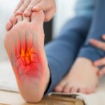 A New Treatment Option for Plantar Fasciitis: Transarterial Embolization (TAE)