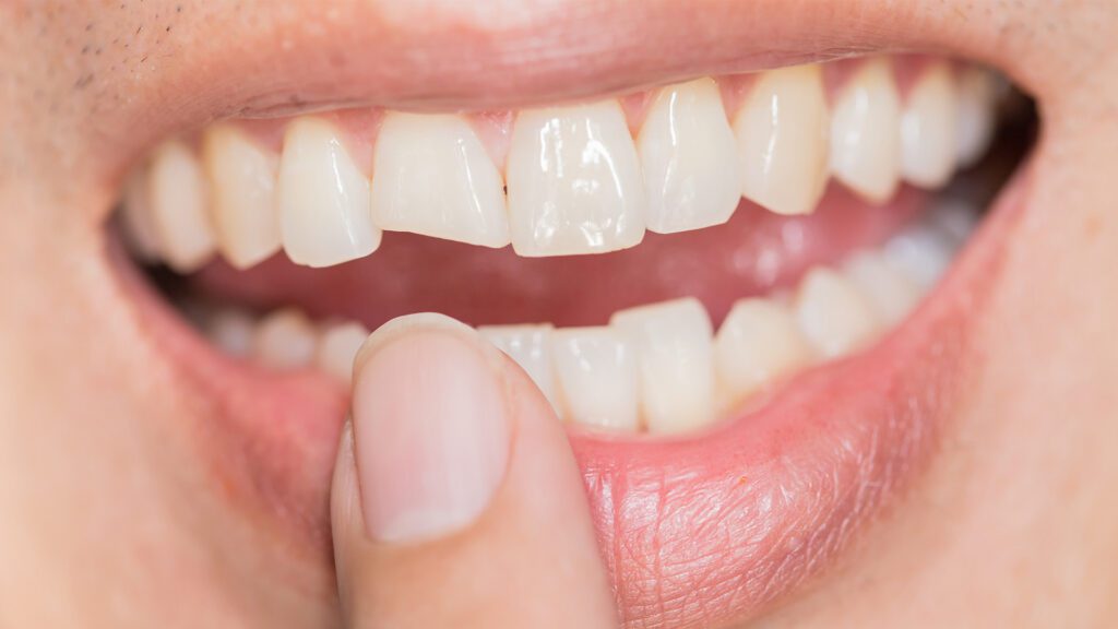 Why Teeth Fail and How We Decide What Will Save Them