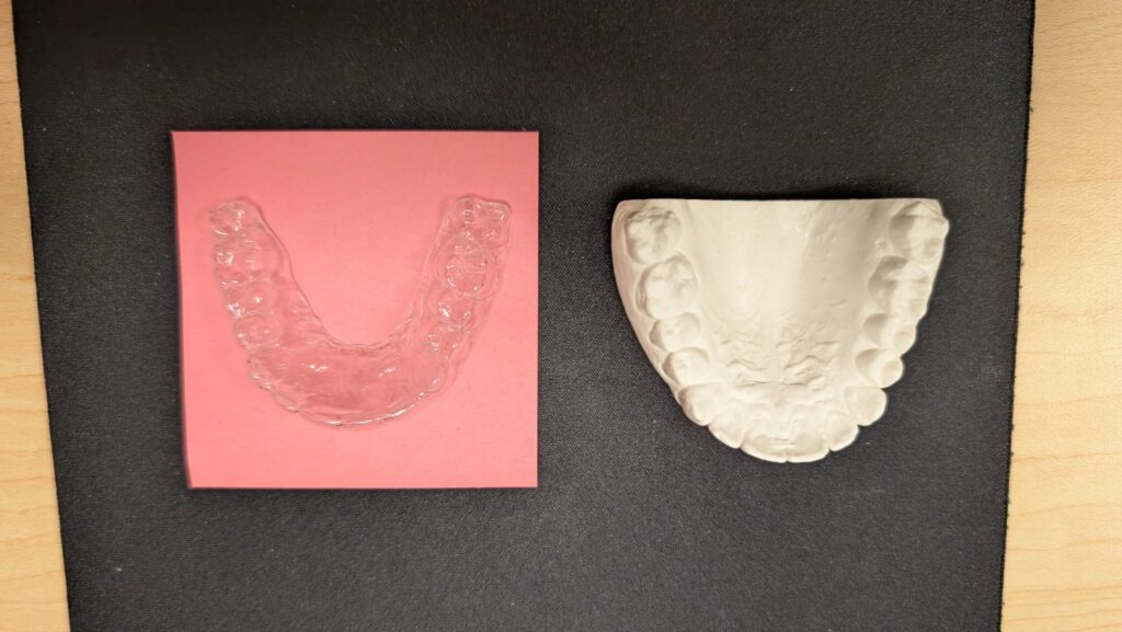 The Importance of Wearing Retainers!
