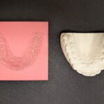 The Importance of Wearing Retainers!