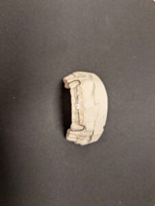 Greeley Orthodontics retainer molds