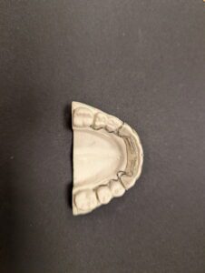 Greeley Orthodontics retainer molds