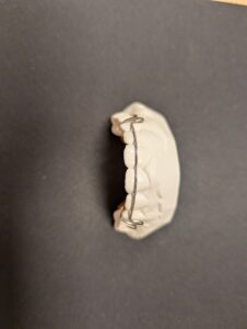 Greeley Orthodontics retainer molds