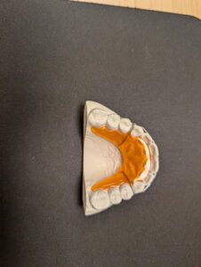 Greeley Orthodontics retainer molds