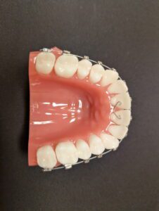 Greeley Orthodontics retainer molds