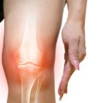 How EMSCULPT NEO® Can Help Support Painful Joints