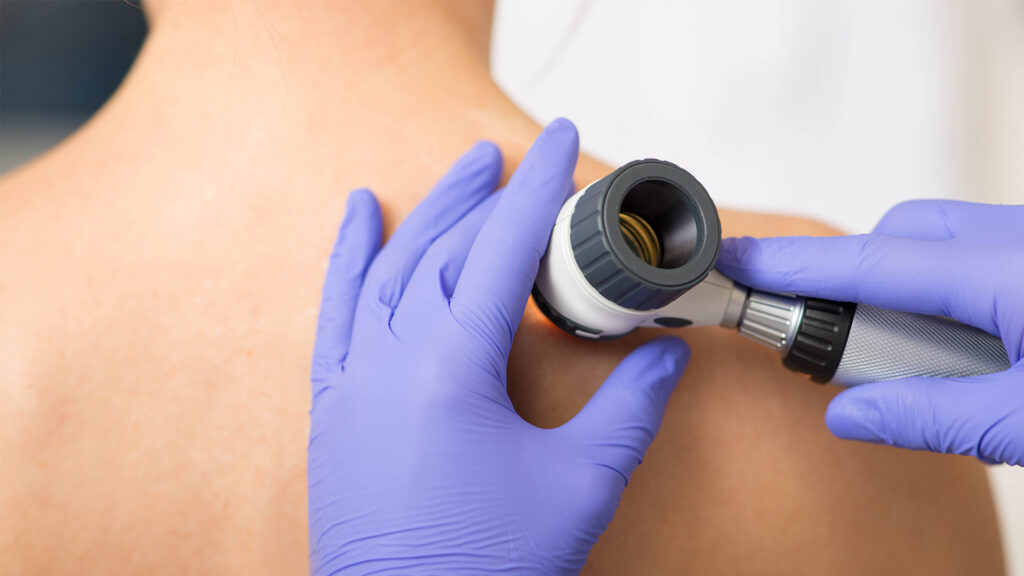 Why the Smallest Cut Is the Best Cut