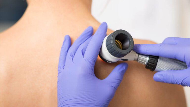 Why the Smallest Cut Is the Best Cut