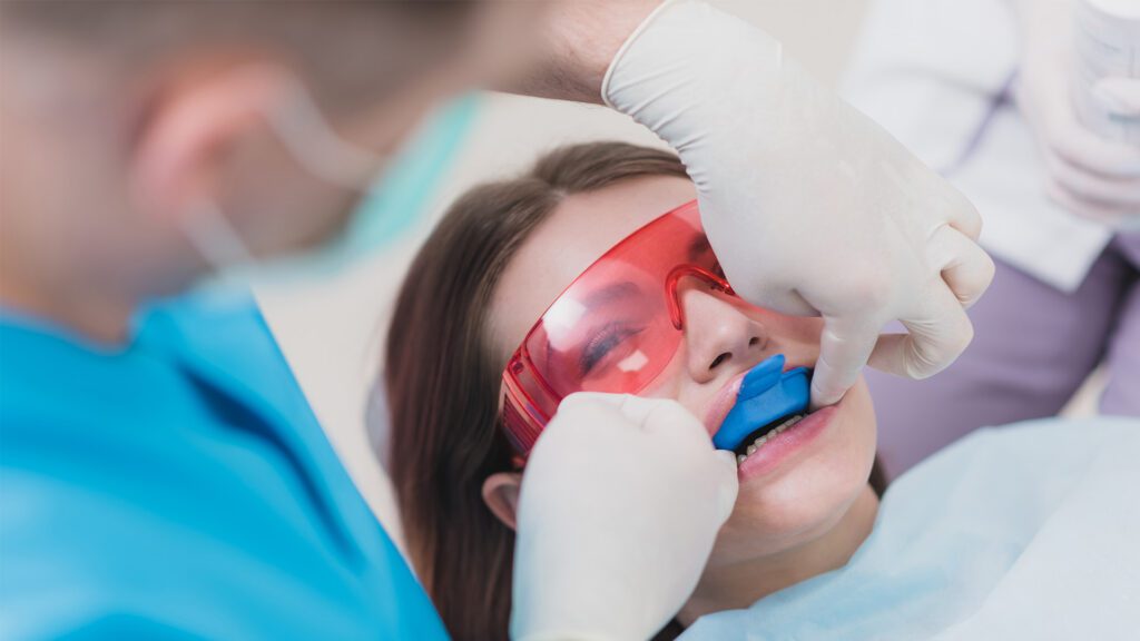 Do I Really Need Fluoride?