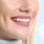 Should I Stay or Should I Go Now… (Tooth Edition)